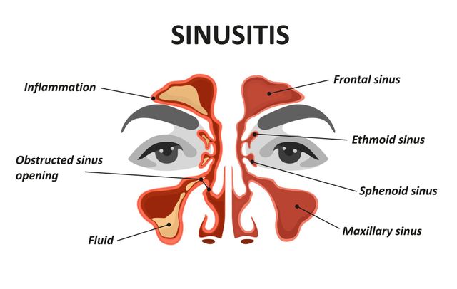 Nasal and Sinus